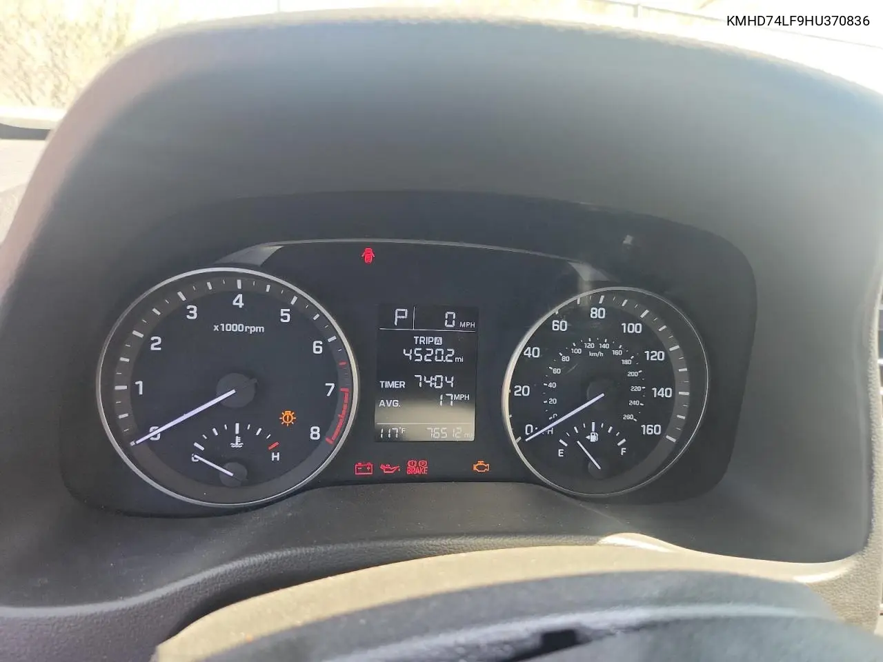 2017 Hyundai Elantra Se VIN: KMHD74LF9HU370836 Lot: 62955515